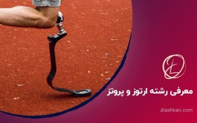 معرفی رشته ارتوز و پروتز